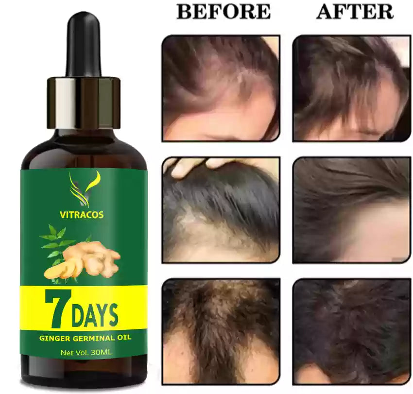 7 Days Hair Grow Serum (30ML)