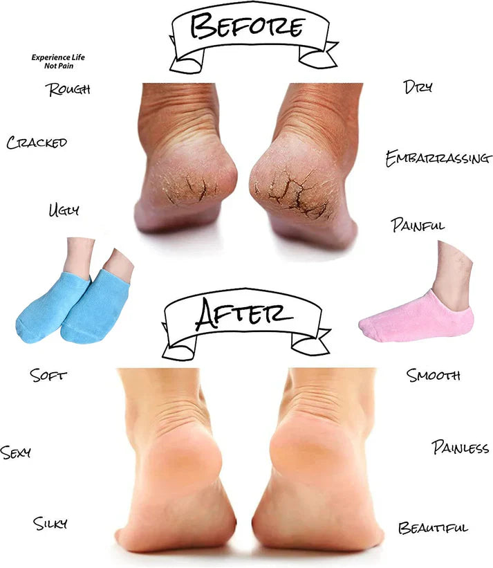 2 Pcs Moisturising Spa Gel Socks