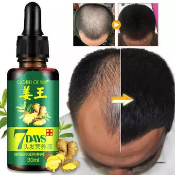 7 Days Hair Grow Serum (30ML)