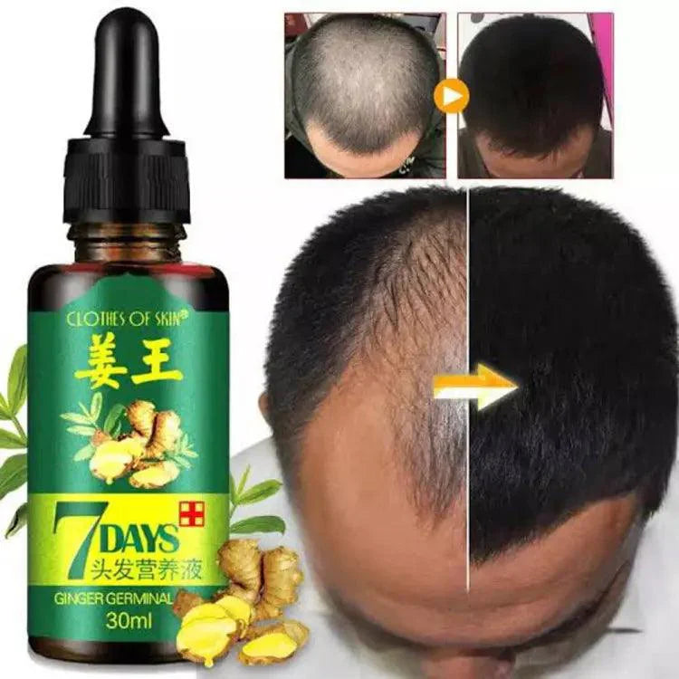 7 Days Hair Grow Serum (30ML)