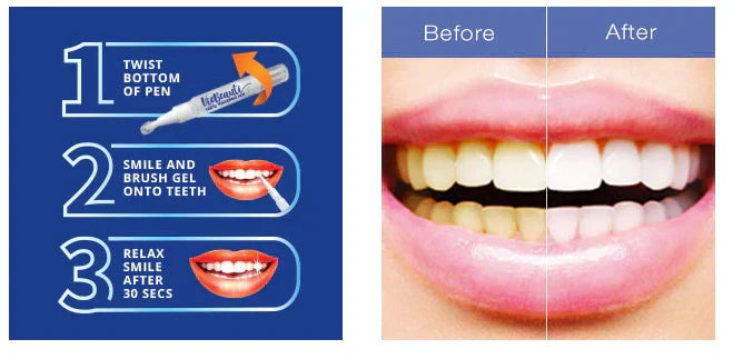 Dazzle Teeth Whitening Polish (Guaranteed Result)