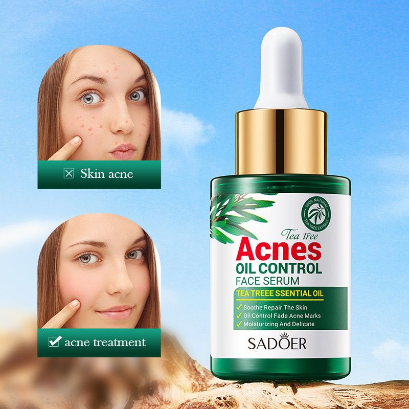 Acne Removing Face Serum 30ML & Whitening Body Serum For Dark Skin (Money Back Guarntee)