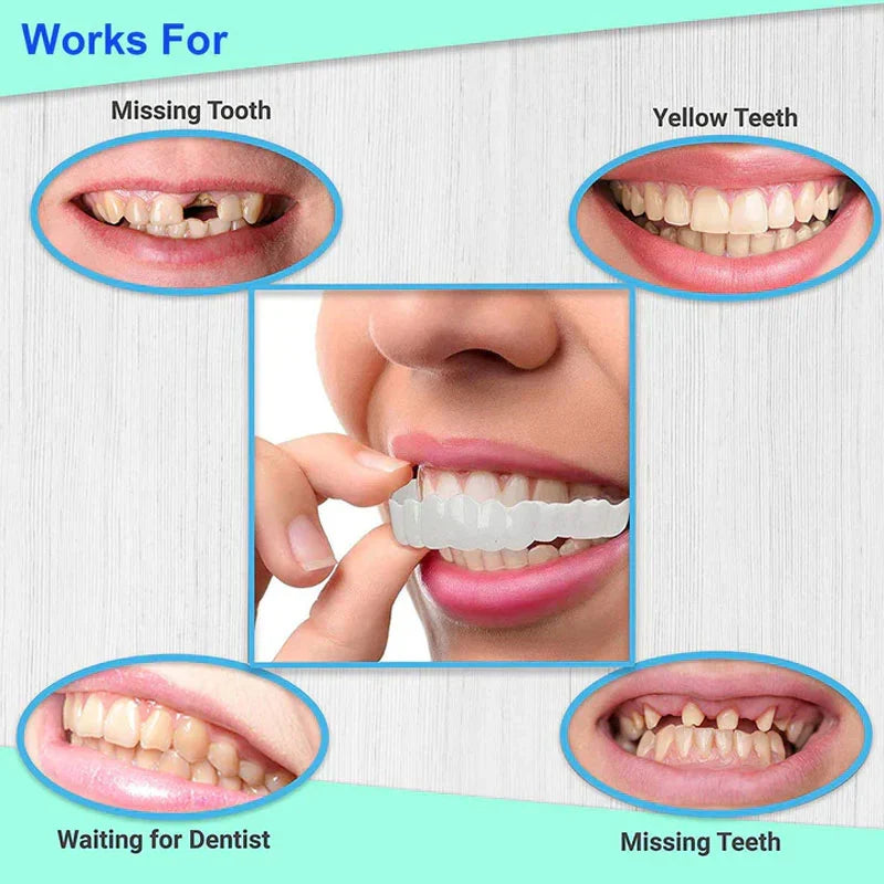 2 Pcs Tooth Cover (One Size Fits All)
