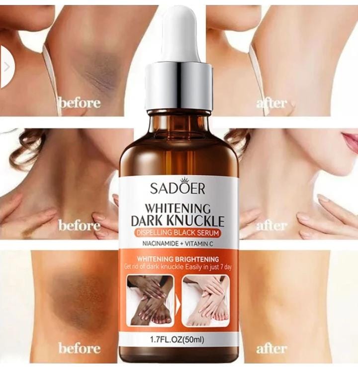 Acne Removing Face Serum 30ML & Whitening Body Serum For Dark Skin (Money Back Guarntee)